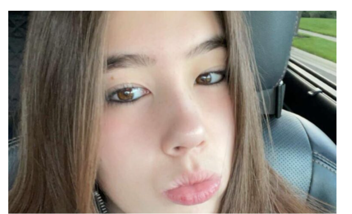 Dublin 17-Year-Old Girl Dies In Two-Vehicle Crash On Hyland Croy Road